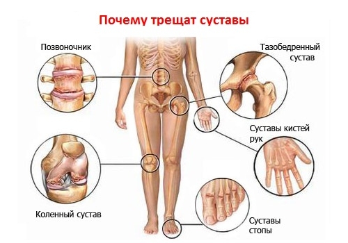 Факторы, влияющие на решение о назначении инвалидности